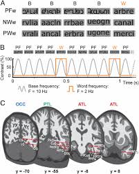 This translation tool will help. Selective Visual Representation Of Letters And Words In The Left Ventral Occipito Temporal Cortex With Intracerebral Recordings Pnas