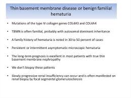Thin basement membrane disease (tbmd, also known as benign familial hematuria and thin basement membrane nephropathy or tbmn) is, along with iga nephropathy, the most common cause of hematuria without other symptoms. Differential Diagnosis Of Nephrotic And Nephritic Syndrome Online Presentation