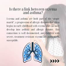 Image result for Allergic Triad