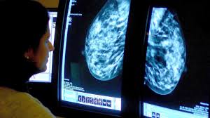 Cancer initiates when normal cells in the breast alter and grow uncontrollably, forming a. Breast Cancer What Are The Symptoms What Are The Causes Of Breast Cancer Itv News