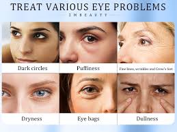 Amazon.com: Under Eye Cream with 5% Caffeine, Dark Circles Under Eye  Treatment with Retinol, Anti Aging Eye Serum with 360° Massage Roller for  Eye Bags, Wrinkles and Puffiness, 0.5 fl. oz :