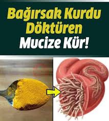 Bagirsak Kurdu Neden Olur Belirtileri Nelerdir Nasil Dusurulur