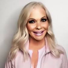 Some safety tips you should follow if you wear contact lenses the.gov means it’s official.federal government websites often end in.gov or.mil. Advanced Eye Care Laser Center 19 Photos Ophthalmologists 3501 Health Center Blvd Bonita Springs Fl Phone Number Yelp