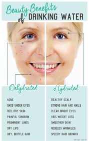 Get Exclusive Tips On How To Heal Skin Inside Out Skin Benefits Water Benefits For Skin Skin Healing