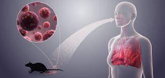 Hantavirus infections definition hantavirus infection is caused by a group of viruses that can infect humans with two serious illnesses: Tula Hantavirus Erstmals Ubertragung Auf Den Menschen Nachgewiesen