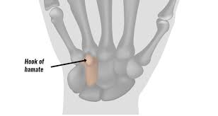 Image result for Hamate Bone