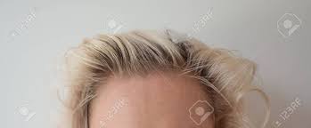 Dry, ageing and itching scalp. Dark Roots Of Hair Overgrown Hair Roots Color Grey Hair Stock Photo Picture And Royalty Free Image Image 149198588