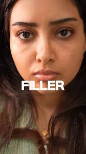 Does it look natural? 😳, PSA. I don’t necessarily recommend it. I’m just  showing my results and experience. I would personally rather get surgery  than filler because it’s permanent and you don’t have ...