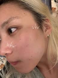 呢排轉季皮膚變到超敏感護膚真係要勁小心呢排成日搽完護膚品都仲乾到爆！有時仲會爆多幾粒暗粒？？! 塊面似同我有仇😓 試咗呢枝雪花秀First Care  Serum終於好啲