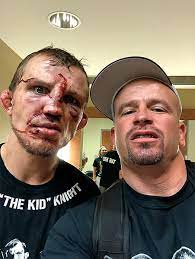 We did not find results for: Lobov Gladiator Pobedil V Krovavoj Rubke I Zhdet Vraga Konora Pancher Blogi Sports Ru