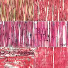 Image result for Oldenlandia echinulosa