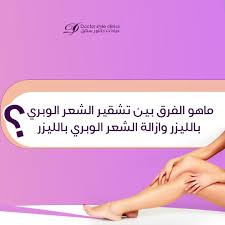 ما هو ليزر التشقير للشعر الوبري تشقير الشعر الوبري بالليزر هو إجراء غير جراحي يتم في عيادات خاصه للعلاج بالليزر وغالبا ما ي ستخدم هذا الإجرا Ios Messenger Ios
