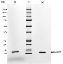 Image result for CSF Protein