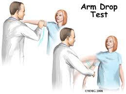Image result for Drop Arm Test