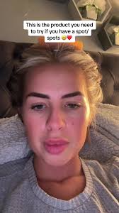 Best Skincare Routine for Spot Treatment with Boots Tea Tree and Witch Hazel