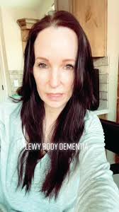 Lewy Body Dementia Robin Will Kiana