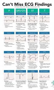 Accelerated Nursing Programs In Pa Homehealth Cardiac Nursing Emergency Medicine Nursing School Survival