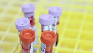 The hospital will arrange this for you. Dubai Health Authority Bans Rapid Viral Testing For Covid 19 Healthcare It News