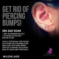 Zystische Akne In Der Nasenfalte Massive Mitesser Auf Der Nase Die Erste Beinhaltet Trea Akn Piercing Aftercare Nose Piercing Bellybutton Piercings