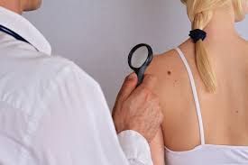 Pengertian kutil kelamin/kemaluan adalah tumbuhnya kulit abnormal yang disebabkan karena virus. Ini Penyebab Dan Cara Menghilangkan Skin Tag Dengan Aman Alodokter