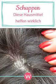 fettige und trockene schuppen diese 7 hausmittel helfen garantiert haare pflegen trockene schuppen und schuppen haare