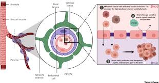 If the cancer has spread to the brain, symptoms may include headaches, speech difficulties, blurred vision or dizziness. Genes That Mediate Metastasis Across The Blood Brain Barrier Trends In Cancer