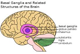 Image result for Chorea