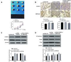 My patients also want to know about signs and symptoms related. Centromere Protein U Cenpu Promoted Bladder Cancer Development In Download Scientific Diagram