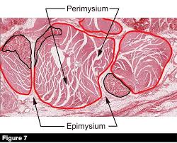 Structure of muscle fibre showing a sarcomere under electron microscope with schematic explanation. Understanding Ligaments And Tendons In Horses American Farriers Journal