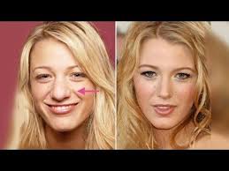 5 Best Celebrity Nose Jobs In Hollywood Before And After Youtube Celebrity Plastic Surgery Blake Lively Plastic Surgery Blake Lively Nose