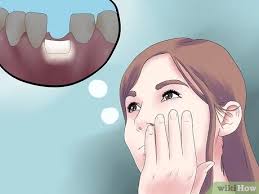 It can eventually lead to the loss of teeth. 3 Ways To Reverse Dental Bone Loss Wikihow
