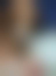 Характерные признаки заболевания