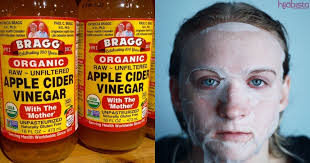 Jika anda memilih untuk turunkan berat badan secara tradisional, epal cider adalah jawapannya. Rupa Rupanya Boleh Hilangkan Jerawat Buat Kulit Bersih Ini 7 Fungsi Hebat Cuka Epal Hijabista