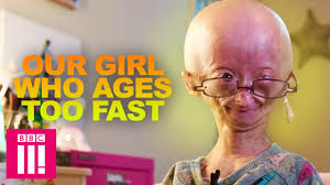 Our Girl Who Ages Too Fast Adalia Rose Living Differently Youtube