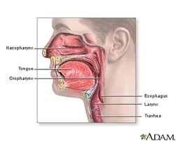Is found in the nasopharynx only or has spread from the nasopharynx to the oropharynx and/or to the nasal cavity. Nasopharyngeal Tumors Jeffrey E Goldberg Md