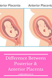 Difference Between Placenta Posterior Anterior Placenta What Is Placenta Anterior Placenta