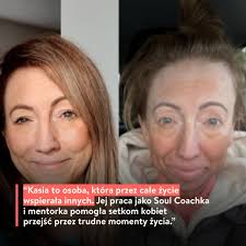 Wesprzyj Kasię w walce o operację i powrót do życia