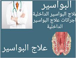 البواسيرالداخلية وماذا تفعل لعلاجها ما الذي يسبب البواسير الداخلية والخارجية وطرق بسيطة لعلاجها عادة ما يكون سبب البواسير زيادة الضغط بسبب الحمل زيادة الوزن