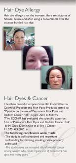 You cannot dye hair black with natural henna dye. Ppd Hair Dye Allergy Renaissance Henna