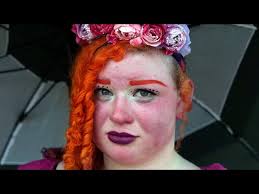 “I am Burning Alive”: Girl Suffers From Rare Skin Condition