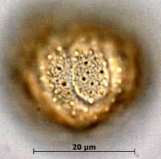 Image result for Eriocaulon truncatum