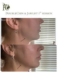 Flawless Medical Aesthetics