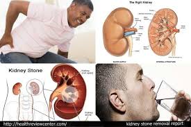 Goooogly Web Just Scroll It To Find Something Valuable Natural Treatments For Kidney Disease Gallbladder Treatment For Kidney Disease Bladder
