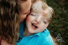 Photo art exhibit honors families of medically fragile children,  stillbirths at Drury thru Oct. 15