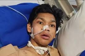 Kondisi David Korban Penganiayaan Mario Dandy Mulai Kesadaran Kuantitaf dan  Organ Vital Tak ada Masalah