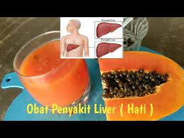Hal ini akan diperparah dengan bakteri yang. Obat Penyakit Liver Penyakit Hati Bengkak Youtube