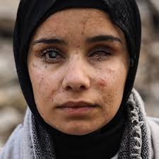 Six-year-old Huda Abu Al-Naja has died after being denied evacuation from  Gaza for treatment. Suffering from severe malnutrition, Huda's family spent  their final days asking when she would be allowed to travel