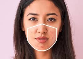 Sharing my 3 hacks to PREVENT maskne and mask rash