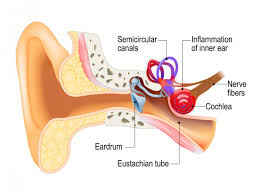 labyrinthitis causes symptoms treatment and recovery