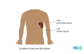 Image result for Shifting Dullness Test